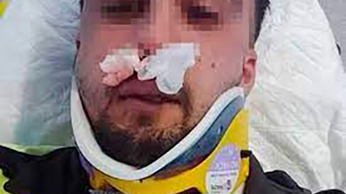 image SIGUE LA ESCALADA DE AGRESIONES A VIGILANTES DE SEGURIDAD EN EL TERRITORIO NACIONAL