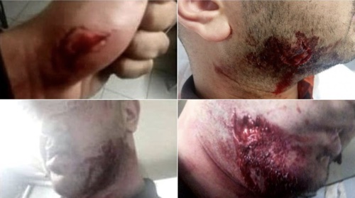 image Agreden a mordiscos a un vigilante de seguridad del metro de Barcelona